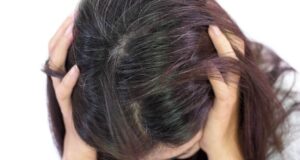 Го знаете ли чувството кога ве боли „косата“? Има објаснување