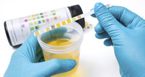 Бактерии во урината – што значат и кога претставуваат проблем?