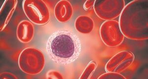 ОВА СЕ СИМПТОМИ НА ТРОМБ ВО ВАШЕТО ТЕЛО! Обрнете внимание – знаци кои не смеете да ги ИГНОРИРАТЕ