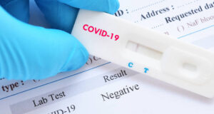 Овие 8 работи мора да ги направи секој кој е позитивен на коронавирус или бил во близок контакт