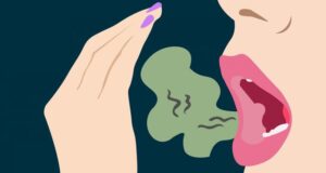 Збогум лош здив! Направете чај од оваа популарна билка