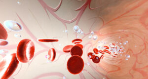 Низок хемоглобин во крвта: Еве зошто се јавува и како да го вратите во нормала!