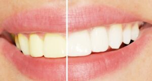 Ова е дефинитивно најлошиот пијалок за бојата на забите, дури и полош од кафето