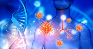 Зајакнете го имунитетот на природен начин