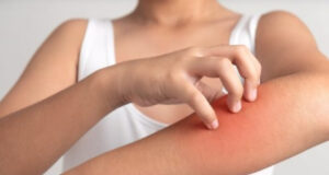 Зошто се чешаме? Постојат четири типа на чешање