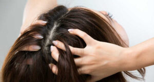 Спасете се од првут и масна коса