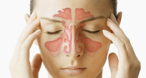 Совети како да се спречи синузитис