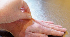 Направете го овој едноставен ТЕСТ и проверете дали вашето ТЕЛО е доволно ХИДРИРАНО