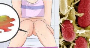 Ешерихија коли – инфекции…