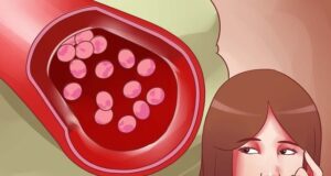 Анемија: Откријте дали сте анемични