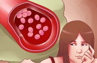 Анемија: Откријте дали сте анемични