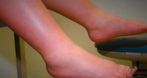 Лек за болни и отечени стапала