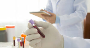 Доколку сакате да го намалите нивото на лошиот холестерол во крвта, ова овошје треба да го јадете еднаш дневно.