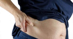 Главниот симптом на опасно висок холестерол