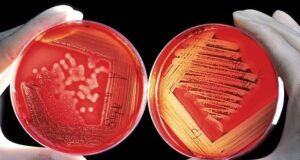 Истражување: Овие БАКТЕРИИ се водечка причина за смрт после срцевите заболувања