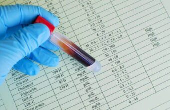 Природни состојки кои го намалуваат холестеролот