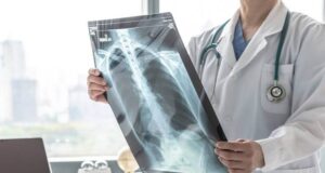 Три опасни симптоми за ХОББ!!