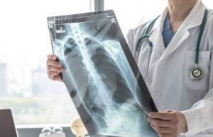 Три опасни симптоми за ХОББ!!