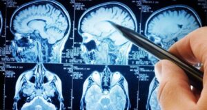 Болести на мозокот