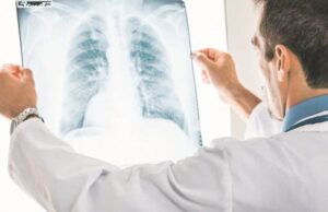 3 ЗАЧИНИ кои ги чистат белите дробови!