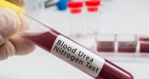Зошто е зголемена Уреата во крвта?