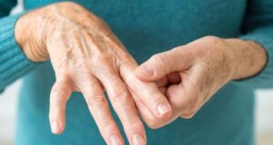 Како се лекува ревматоидниот артритис?