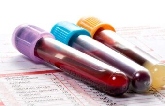 Холестерол и триглицериди…