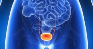 Дали вашиот мочен меур е преактивен?