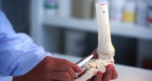 Намирници кои ги зајакнуваат коските…