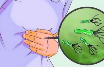 Хеликобактер пилори