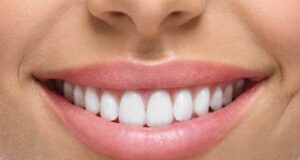 Избелeте ги забите природно