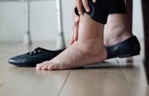 Нозете ви отекуваат и ја задржувате водата во телото