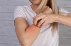 Овие намирници предизвикуваат алергии