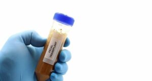 Сè попопуларен третман со човечки измет: Се појави нов лек – капсули со живи спори