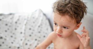 Сипаници – Сè што треба да знаете