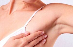 Ова се првите симптоми кои може да укажуваат на рак на дојка