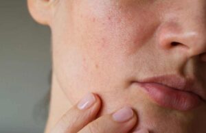 Висок е ШЕЌЕРОТ? Ќе ги откриете првите СИМПТОМИ на вашето ЛИЦЕ, затоа добро гледајте се во ОГЛЕДАЛО секое утро