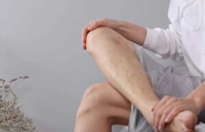 Можеби имате тромб без да знаете: Овие симптоми непогрешливо откриваат