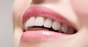 3 народни методи против забен камен: Сакајте ја вашата насмевка