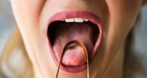 Овие намирници се КАНДИДА УБИЕЦ – Храна која помага да се ослободите од досадната габична инфекција