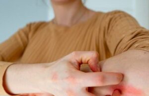 Од дијабетес, стрес до нарушувања на тироидната жлезда: Еве што открива кожата за нашето здравје