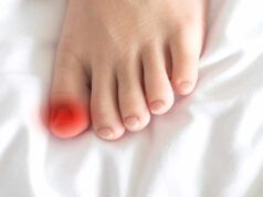 Габи на ноктите на нозете: причини и решенија