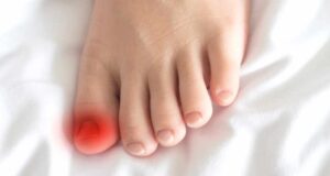 Габи на ноктите на нозете: причини и решенија