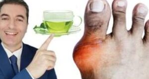 ЧАЈ кој го отстранува вишокот на мочна киселина (ВИДЕО)
