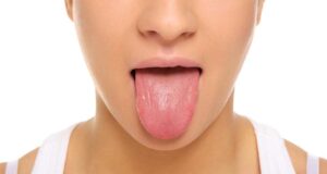 Пет работи кои вашиот јазик може да ги открие за вашето здравје – од рак до мозок