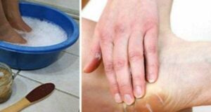 Ослободете се од сувите и испукани стапала за 10 МИНУТИ! Ова е тајниот рецепт…