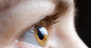 Што е астигматизам и кои се неговите симптоми?