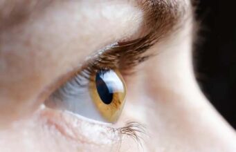 Што е астигматизам и кои се неговите симптоми?