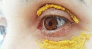 Ставила куркума околу очите, 10 минути подоцна се случило нешто неверојатно!