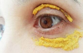 Ставила куркума околу очите, 10 минути подоцна се случило нешто неверојатно!